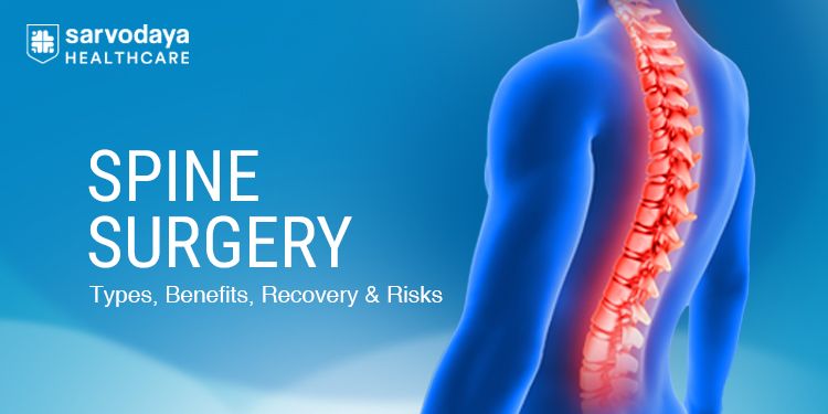 Spine Surgery - Types, Benefits, Recovery & Risks