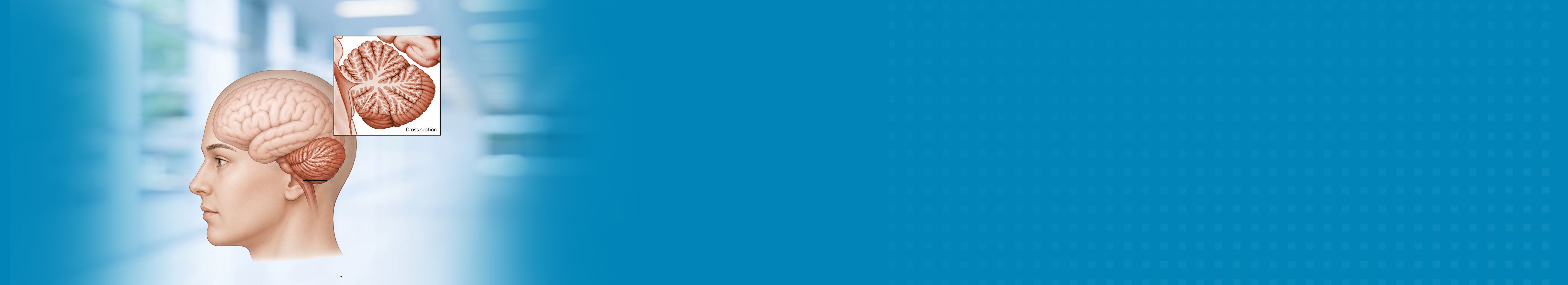 Best Ataxia Treatment Hospital