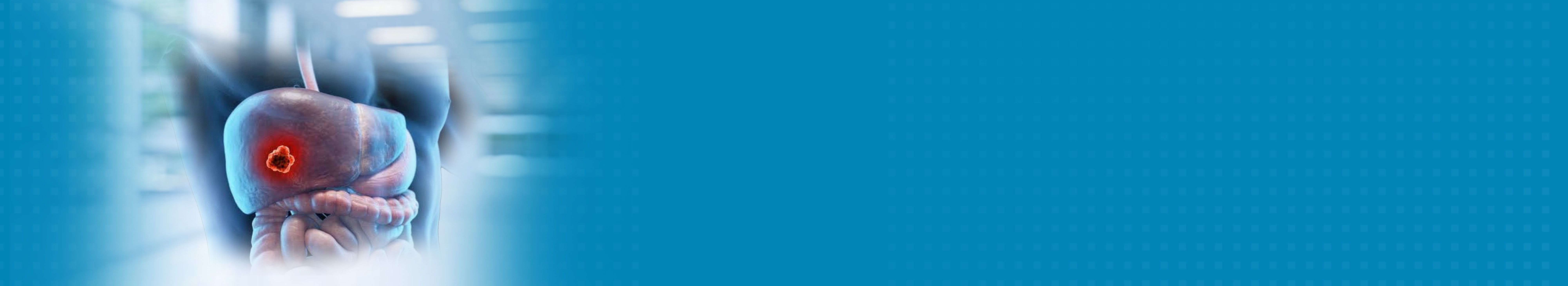 Best Benign Liver Tumour Hospital