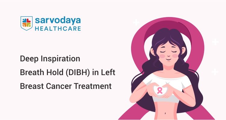 Deep Inspiration Breath Hold (DIBH) in Left Breast Cancer Treatment