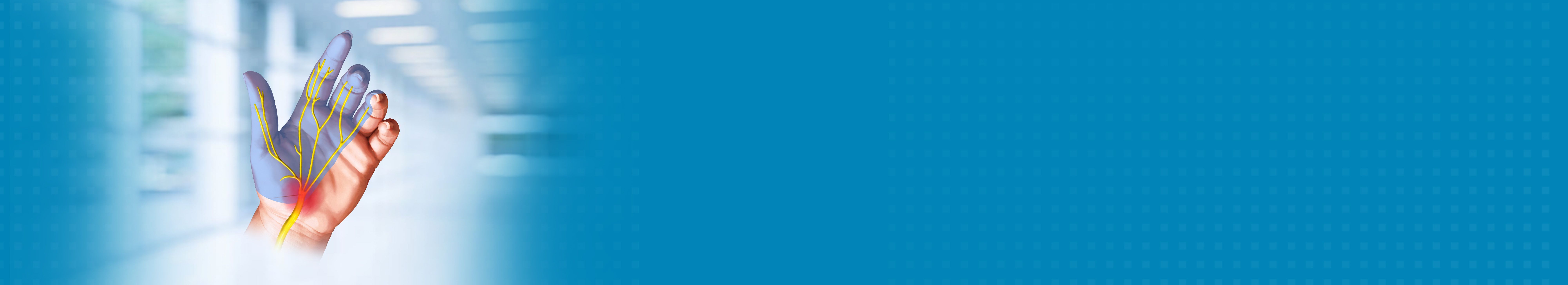 Carpal Tunnel Syndrome Treatment Hospital