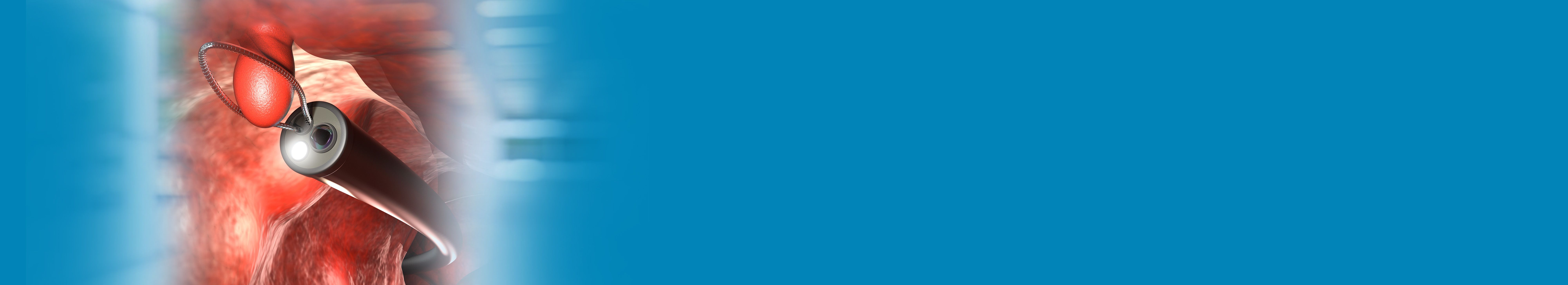 Best Colonoscopy Treatment Hospital