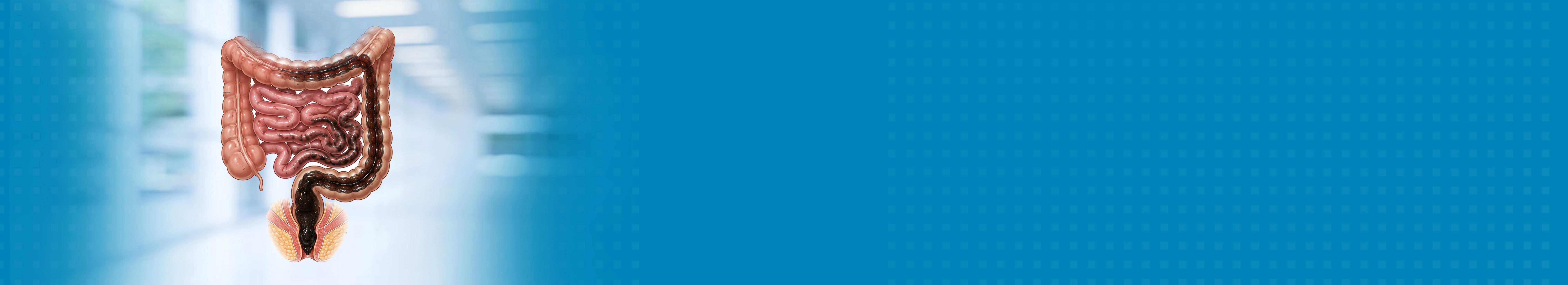 Best Melena Treatment Hospital