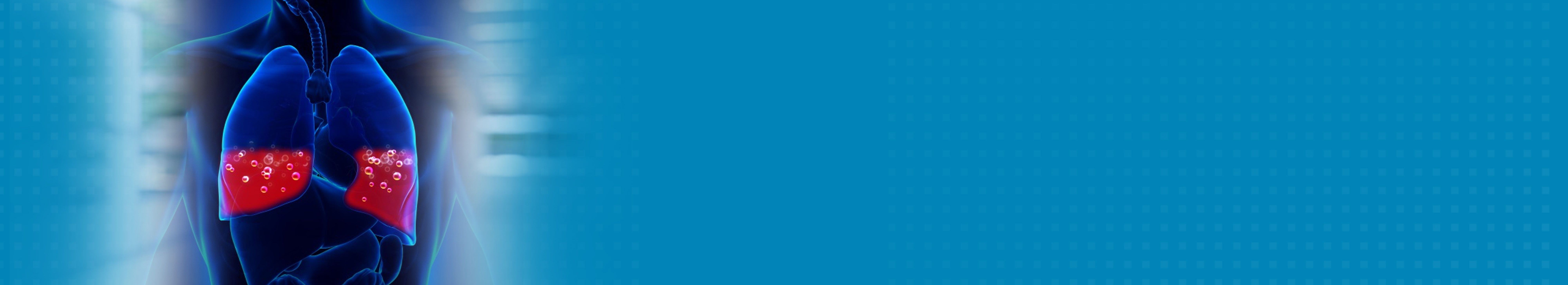 Best Pulmonary Edema Treatment Hospital