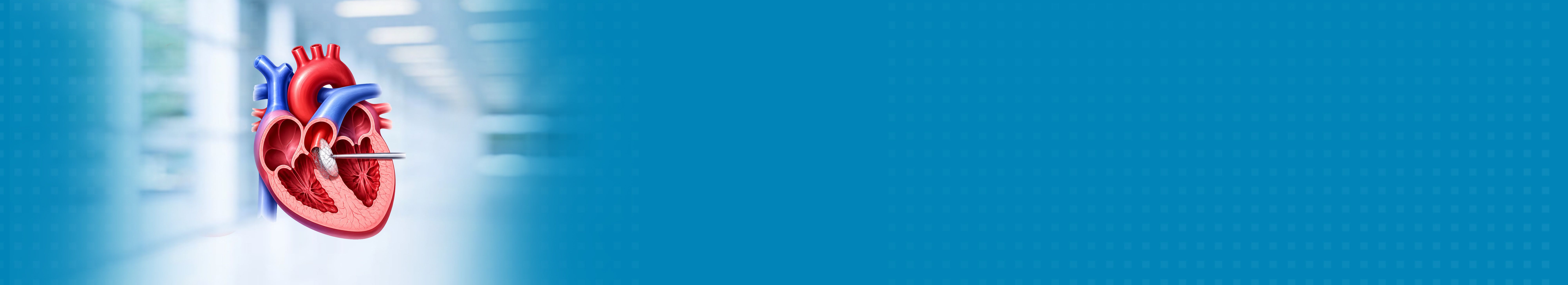 Best Ventricular Septal Defect Repair (VSD) Hospital