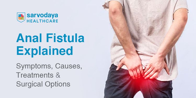 Anal Fistula Explained: Symptoms, Causes, Treatments & Surgical Options