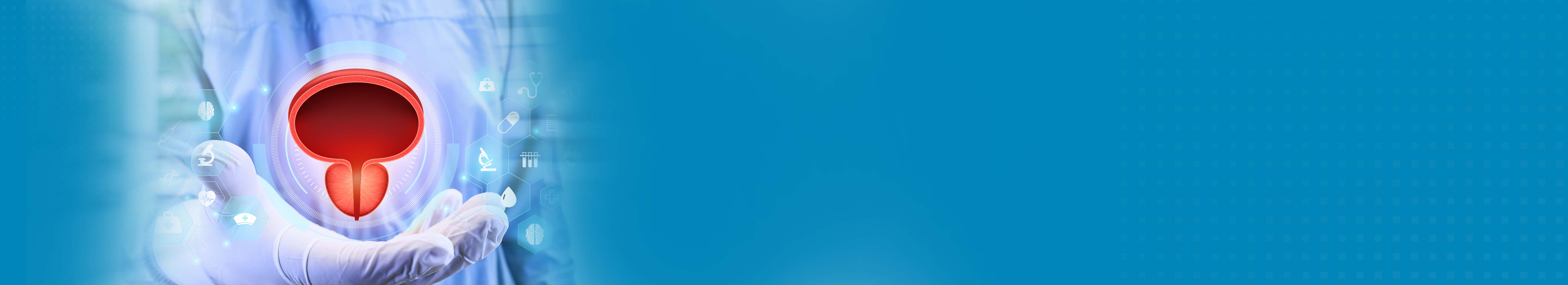 Best Hospital For Bladder Cancer Treatment