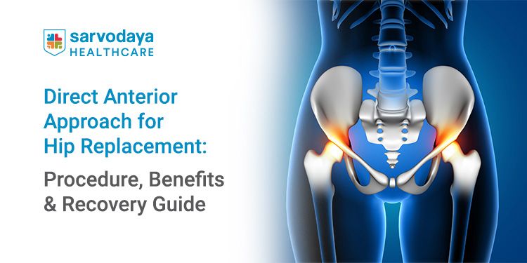 Direct Anterior Approach for Hip Replacement: Procedure, Benefits & Recovery