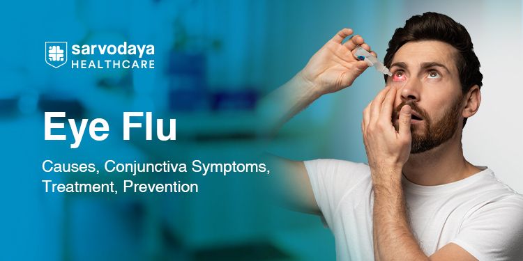Eye Flu: Causes, Conjunctiva Symptoms, Treatment, Prevention