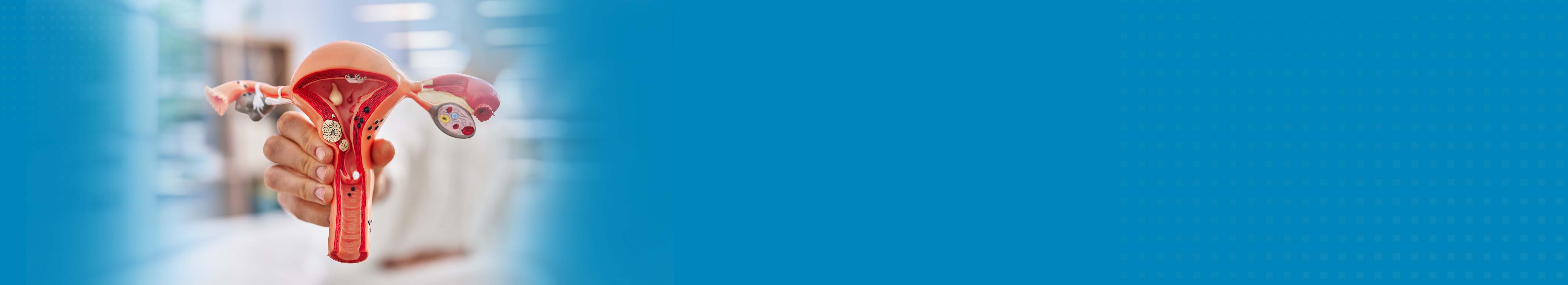 Best Hospital for Gynecological Cancer Treatment