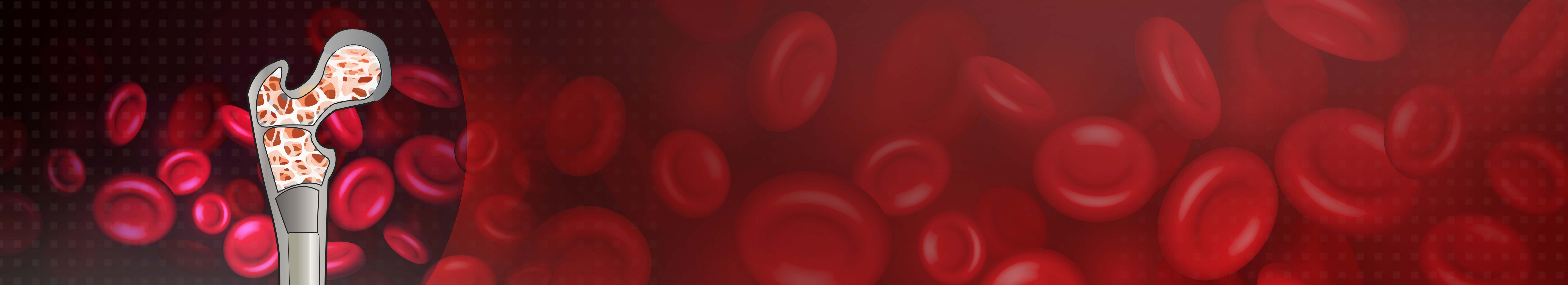 Best Bone Marrow Transplant Hospital in Delhi NCR, India