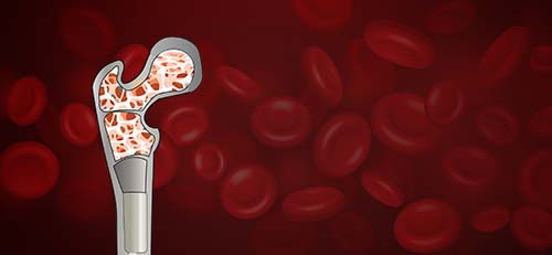 Best Bone Marrow Transplant Hospital in Delhi NCR, India