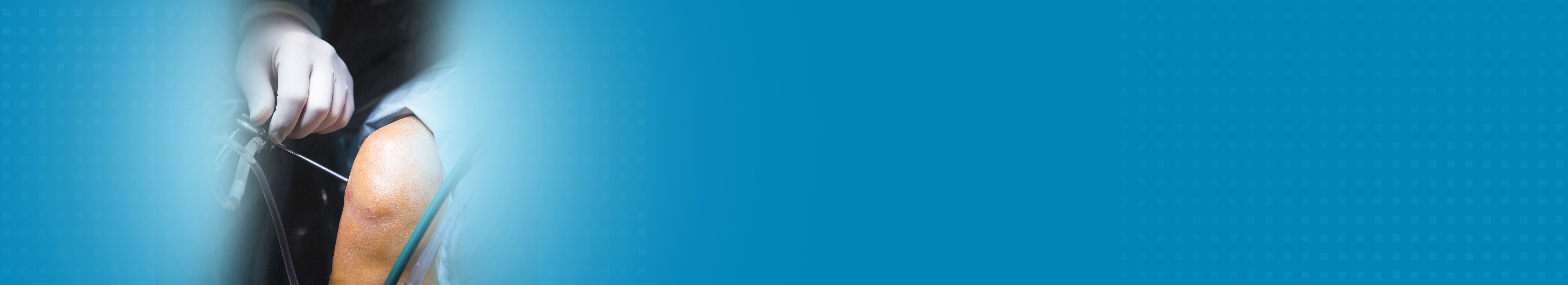 Best Hospital For Knee Preservation Surgery