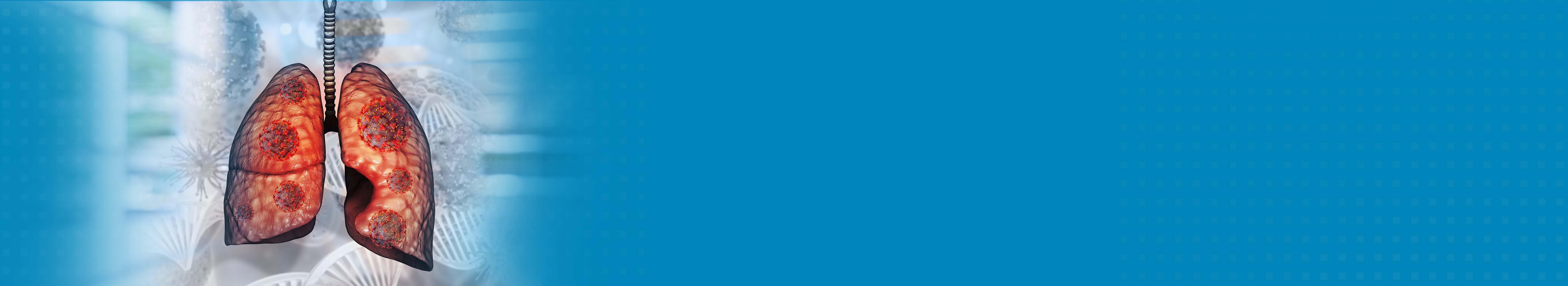 Best Hospital For Lung Cancer Treatment