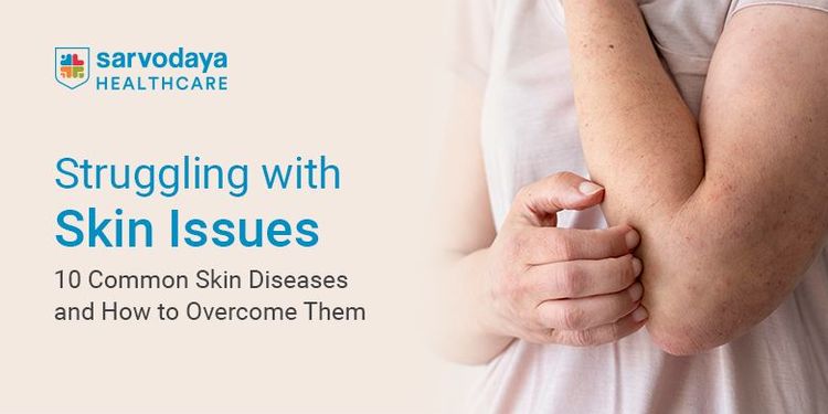 10 Common Skin Diseases and How to Overcome Them
