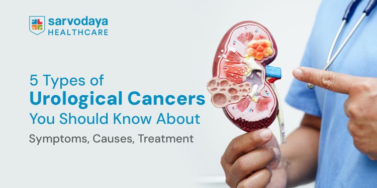 5 Types of Urological Cancers You Should Know About: Symptoms, Causes, Treatment