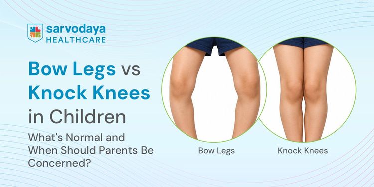Bow Legs vs Knock Knees in Children: What's Normal and When Should Parents Be Concerned?