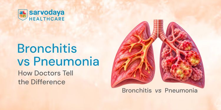 Bronchitis vs Pneumonia: How Doctors Tell the Difference