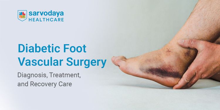 Diabetic Foot Vascular Surgery: Diagnosis, Treatment, and Recovery Care