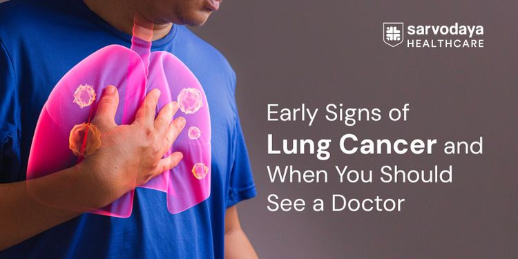 Early Signs of Lung Cancer and When You Should See a Doctor
