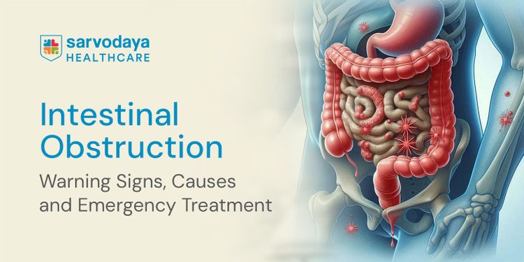 Intestinal Obstruction: Warning Signs, Causes and Emergency Treatment