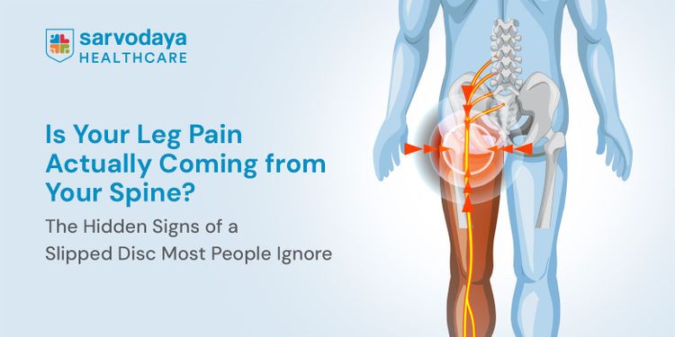 Is Your Leg Pain Actually Coming from Your Spine? The Hidden Signs of a Slipped Disc Most People Ignore