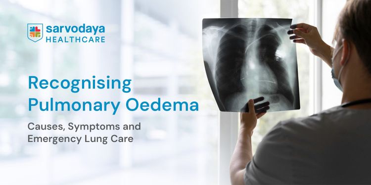 Recognising Pulmonary Oedema: Causes, Symptoms and Emergency Lung Care