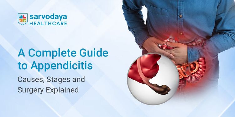 A Complete Guide to Appendicitis: Causes, Stages and Surgery Explained