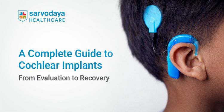 A Complete Guide to Cochlear Implants: From Evaluation to Recovery