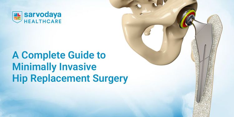 A Complete Guide to Minimally Invasive Hip Replacement Surgery