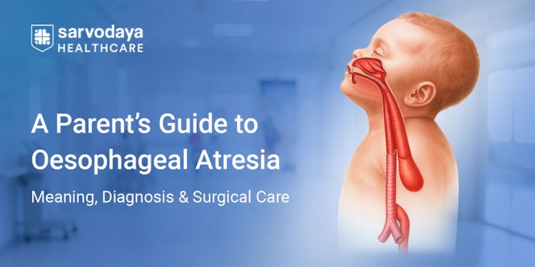 A Parent’s Guide to Oesophageal Atresia: Meaning, Diagnosis & Surgical Care