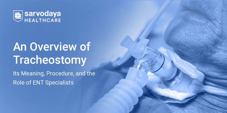 An Overview of Tracheostomy: Its Meaning, Procedure, and the Role of ENT Specialists