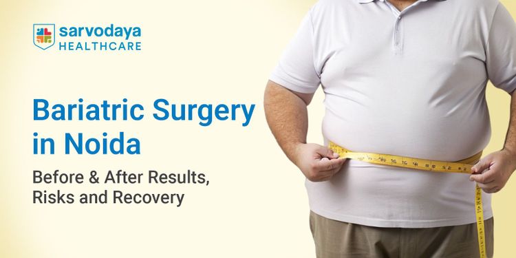 Bariatric Surgery in Noida: Before & After Results, Risks and Recovery