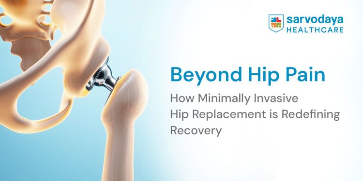 Beyond Hip Pain: How Minimally Invasive Hip Replacement is Redefining Recovery