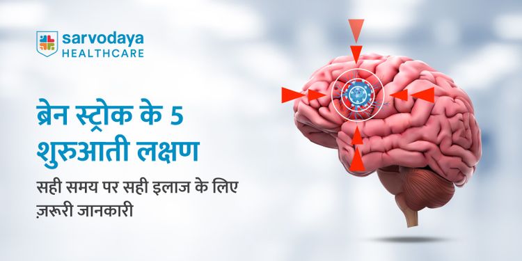 ब्रेन स्ट्रोक के 5 शुरुआती लक्षण: सही समय पर सही इलाज के लिए ज़रूरी जानकारी