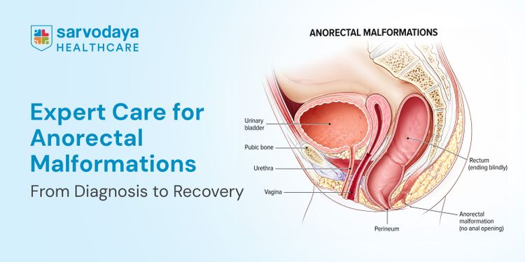 Expert Care for Anorectal Malformations: From Diagnosis to Recovery