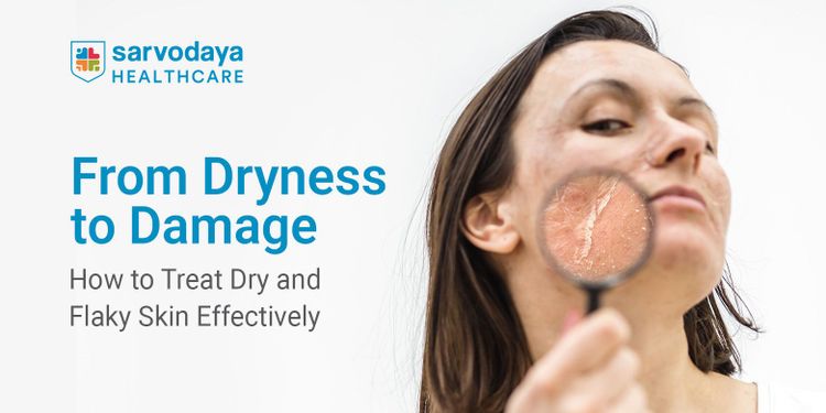 From Dryness to Damage: How to Treat Dry and Flaky Skin Effectively