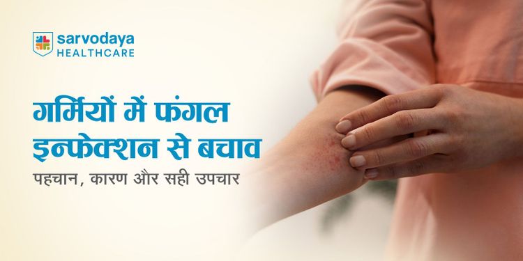 गर्मियों में फंगल इन्फेक्शन से बचाव: पहचान, कारण और सही उपचार