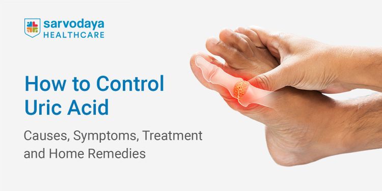 How to Control Uric Acid: Causes, Symptoms, Treatment and Home Remedies