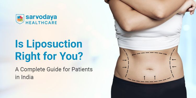 Is Liposuction Right for You? A Complete Guide for Patients in India