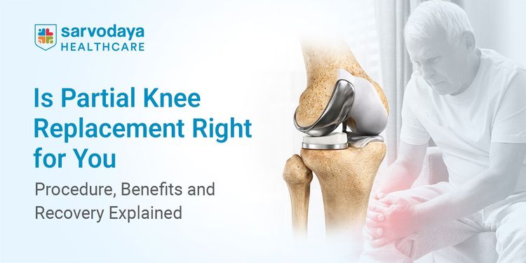 Is Partial Knee Replacement Right for You? Procedure, Benefits and Recovery Explained