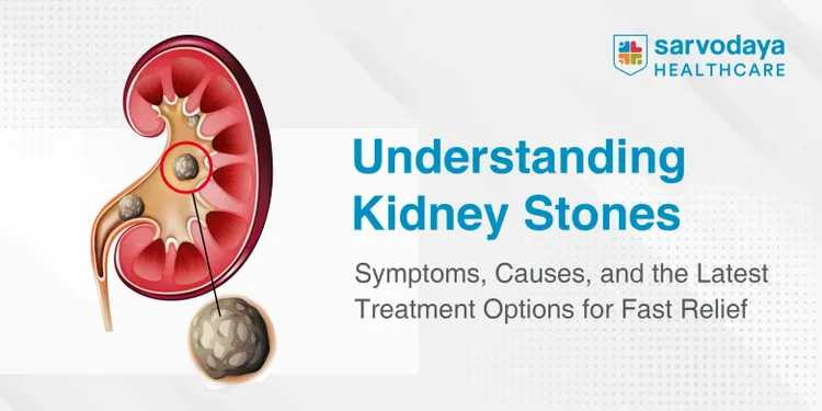 Understanding Kidney Stones: Symptoms, Causes, and the Latest Treatment Options for Fast Relief