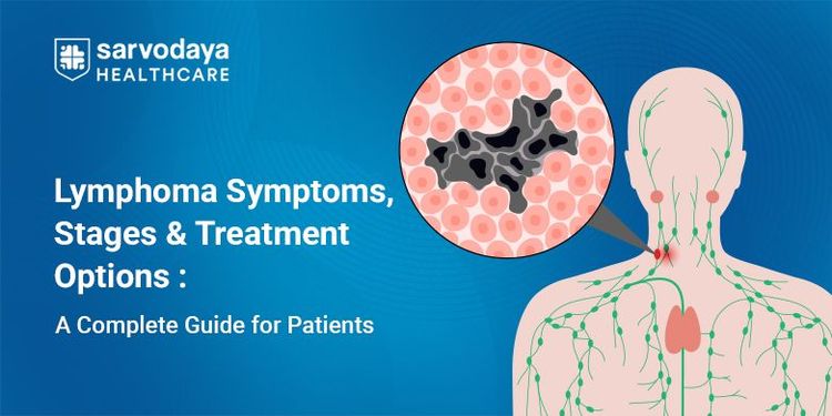 Lymphoma Symptoms, Stages & Treatment Options
