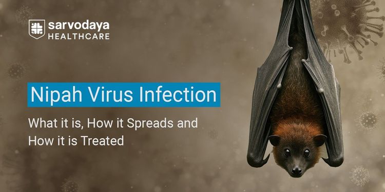 Nipah Virus Infection: What It Is, How It Spreads and How It Is Treated