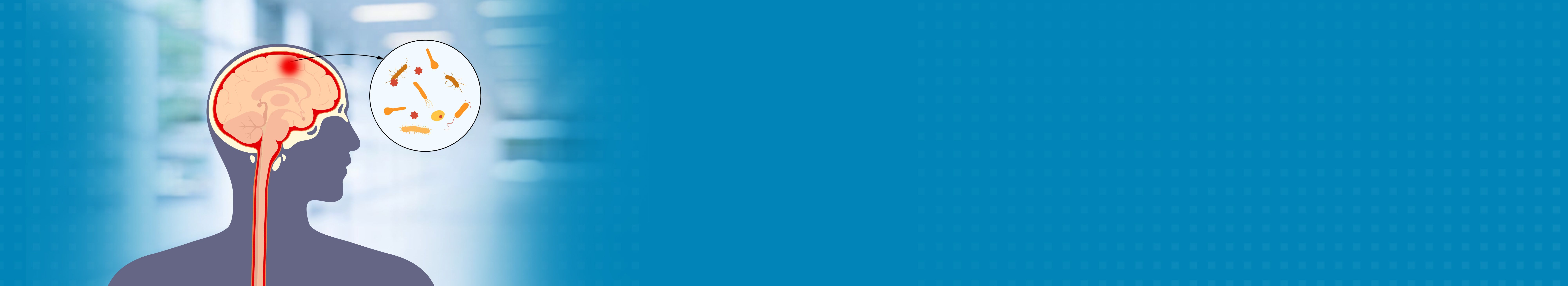 Best Hospital For Meningitis Treatment