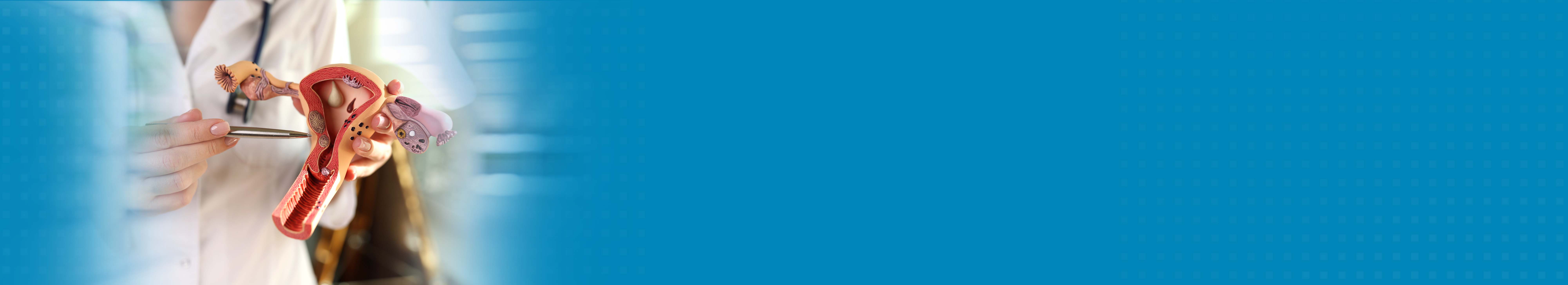 Best Hospital For Ovarian Cancer Treatment