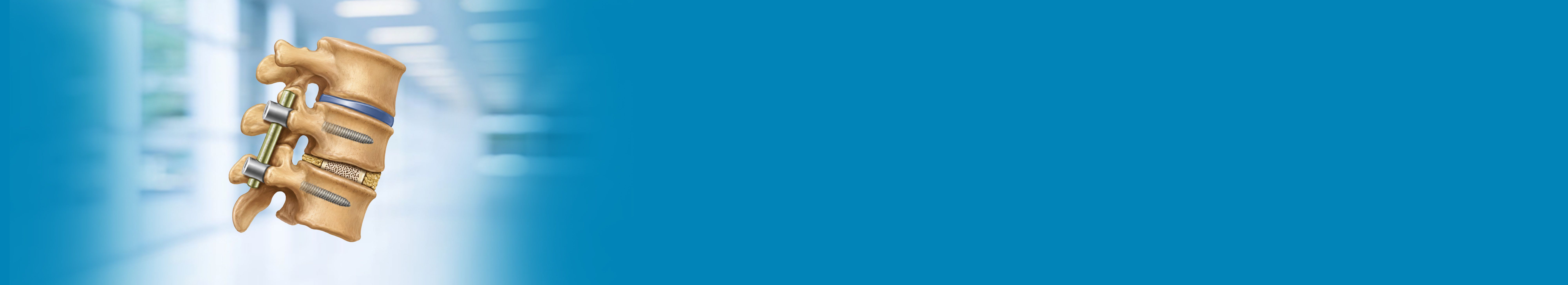 Best PLIF Surgery Hospital