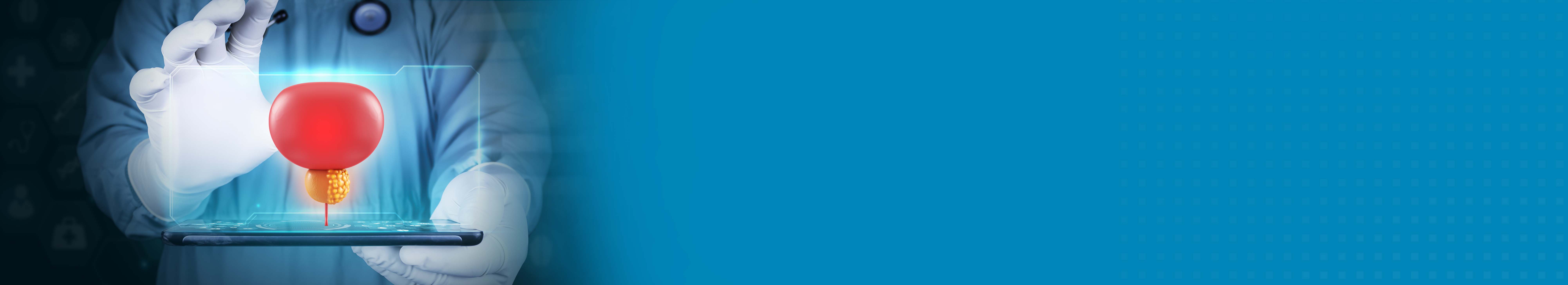 Best Hospital For Prostate Cancer Treatment