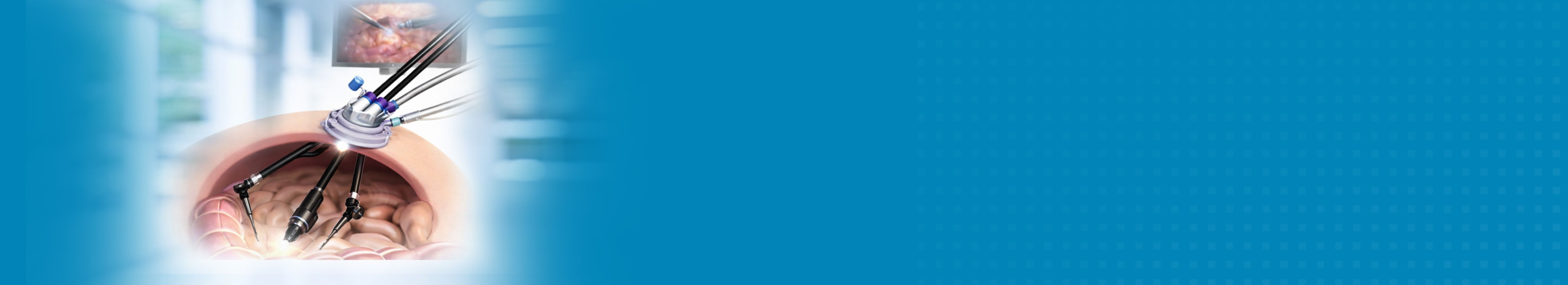 Best Hospital for Single Incision Laparoscopic Surgery