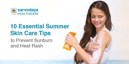 10 Essential Summer Skin Care Tips to Prevent Sunburn and Heat Rash